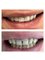 Dental Clinic New Smile - Rruga  Nikolla Tupe, Tirana, Albania, 1019,  30