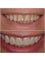Dental Clinic New Smile - Rruga  Nikolla Tupe, Tirana, Albania, 1019,  38