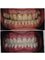 Dental Clinic New Smile - Rruga  Nikolla Tupe, Tirana, Albania, 1019,  33