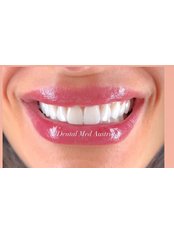 Zirconia Crown - Dental Med Austria