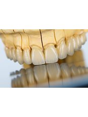 CAD/CAM Dental Restorations - Dilo Dental Center