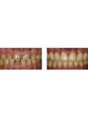 Cosmetic Dentist Consultation - Klinika Dentare