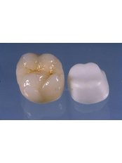 Dental Crowns - Klinika Dentare
