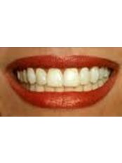 Teeth Whitening - Orthodontic Clinic 