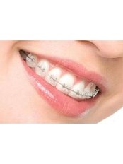 Ceramic Braces - Orthodontic Clinic 