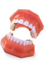 Braces - Orthodontic Clinic 