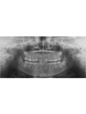 Orthodontist Consultation - Orthodontic Clinic 