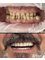 Sanart Dental Studio - Before&After. Great teeth don't happen by chance. They happen by appointment! 