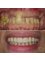 Toronto Dental Clinic Albania - All on six dental implants + zirconia bridge 
