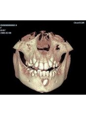 3D Dental X-Ray - Compass Dental Care