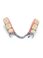 Chrome Dentures - Brisbane Dental & Denture Clinic