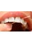 Southside Dental Group Richlands - gum disease management 