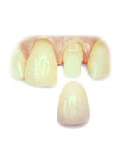 Dental Crowns - Paradise Smiles Dental Surgery