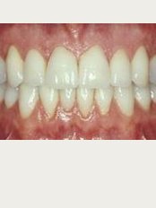 Denture Care Professionals Australia - Natural Looking Dentures