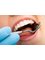 Smile Design Denture Clinic - 2/26 Michigan Dr, Oxenford, Gold Coast, Qld, 4210,  2