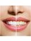 High Dental - Teeth Whitening Melbourne  