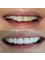 Gorgeous Smiles Dentistry - 121 Exhibition Street, Melbourne, VIC, 3000,  3