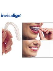 Invisalign™ - DHealth Dentistry