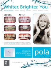 Teeth Whitening - DHealth Dentistry