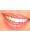 Bright Smile Dental Clinic - 412 Murray Road, Preston, VIC, 3072,  6