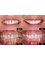 Bright Smile Dental Clinic - 412 Murray Road, Preston, VIC, 3072,  10
