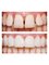 Bright Smile Dental Clinic - 412 Murray Road, Preston, VIC, 3072,  11