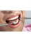 Simply Smiles Dental - Level 4, Trak Centre, 445 Toorak Rd, Toorak, VIC, VIC 3142,  3