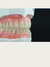 Balance Denture Clinic - Customised Complete Dentures