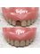 Total Denture Care - Denture repair 