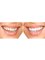 Radiant Smiles Dental Care - Yokine - 198 Wanneroo Road, Wanneroo, WA, 6060,  2