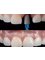 Brace Orthodontics & Dental Care - Bashundhara R/A - dental Implant 