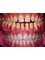 Dental Brace & Implant Clinic - DENTAL HOME, House :76, Block: D, Road: 11, Banani, Dhaka, Dhaka, 1213,  2