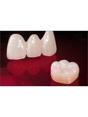 Dental Crowns - Dental City & Orthodontics