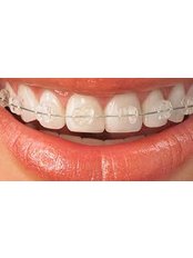 Ceramic Braces - Dental City & Orthodontics