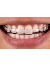 Bite Guard - Dental City & Orthodontics