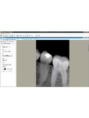 Digital Dental X-Ray - Luxadent Dental Office - Johan Willemsens
