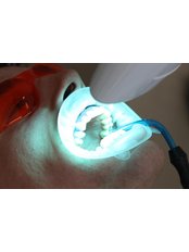 Laser Teeth Whitening - Luxadent Dental Office - Johan Willemsens