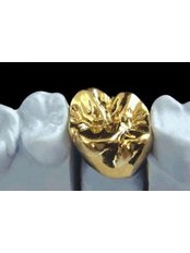 Gold Crown - Luxadent Dental Office - Johan Willemsens