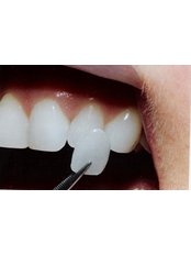 Restorative Dentist Consultation - Dr. Luiz Alberto Ferraz de Caldas - Unidade Miguel Pereira - Miguel Pereira Branch