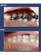 Cosmetic Dentist Consultation - Dr. Luiz Alberto Ferraz de Caldas - Unidade Miguel Pereira - Miguel Pereira Branch