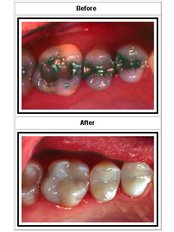 Cosmetic Dentist Consultation - Dr. Luiz Alberto Ferraz de Caldas