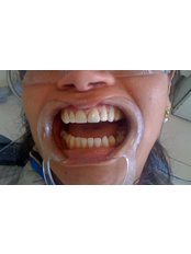 Cosmetic Dentist Consultation - Dr. Priscila Barreto