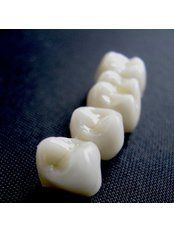 Dental Bridges - BG Denta