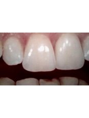 CAD/CAM Dental Restorations - MK DENT LTD