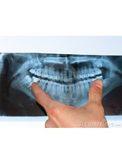 Panoramic Dental X-Ray - Ribagin Dent