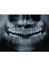Digital Panoramic Dental X-Ray - Ribagin Dent