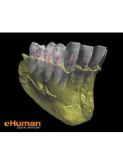 3D Dental X-Ray - Ribagin Dent