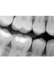 Dental X-Ray - Ribagin Dent