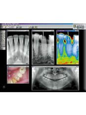 Digital Dental X-Ray - Ribagin Dent