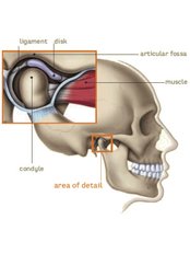 TMJ - Temporomandibular Joint Treatment - Ribagin Dent